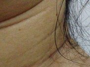 巨胖女子为了和丈夫更加亲昵，奋力去掉150公斤的肉成为女神