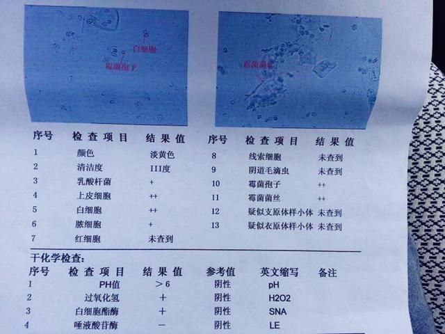 看懂这张孕检单，就知道你能不能顺产