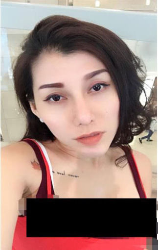 女星隆胸后搭飞机胸部假体炸裂,险出生命危险就医照曝光 电子游艺在线