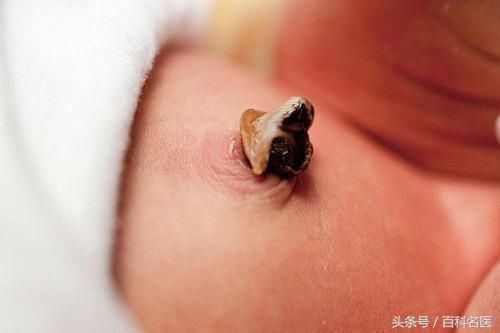 从肚脐辨疾病,什么样的肚脐最健康?