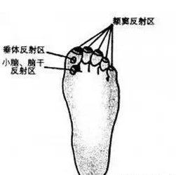 老年痴呆很可怕，预防原来这么简单，可惜99%的人不知道