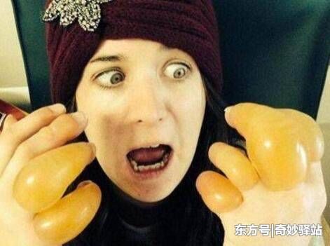 俄罗斯美女聚会后醉倒,在街上冻了一晚,醒后发现手指“变异”了