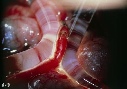 「试管必读」试管婴儿最经典问题18问标准答