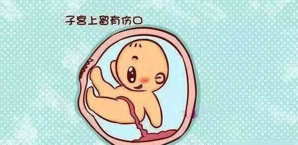 一胎是剖腹产,二胎要多少周的时候生?经历过的