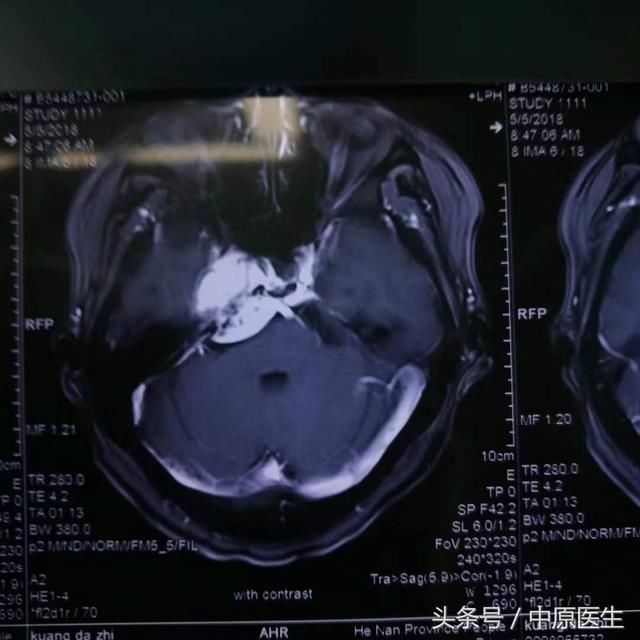 滕王阁很美，来南昌参加学术会议的专家却一直在反省做的三个手术