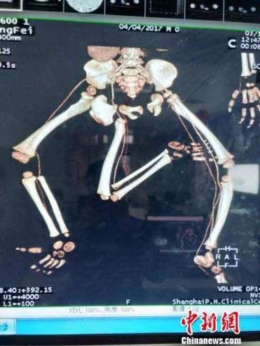\