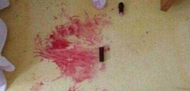 3岁孩子独自在家,妈妈回家后看到了一摊血。