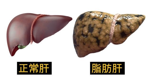 t0115218941cecc9951.jpg
