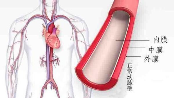 背痛一天后突然去世，医生都措手不及，啥病这么恐怖?