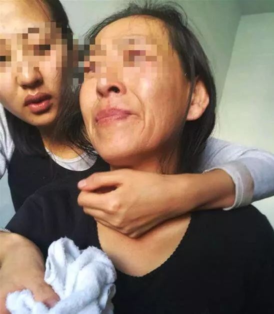 女硕士之父被砍死调查：凶手并非村霸 已是二次上门