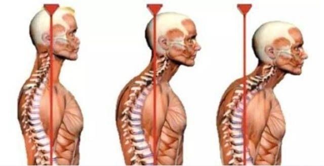 总感觉颈后有大包,怎么回事,如何去掉?