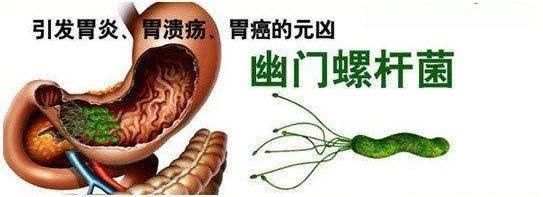 幽门螺旋杆菌的死对头终于找到了,早上吃一点