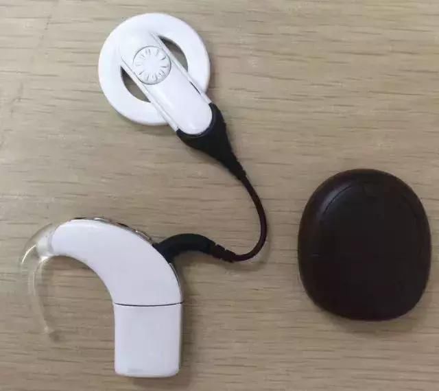 怀化惠耳助听器:人工耳蜗+助听器双模干预