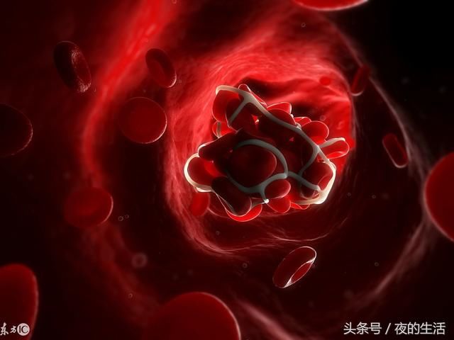 吃这两种药物真的可部分代替心脏支架手术吗?