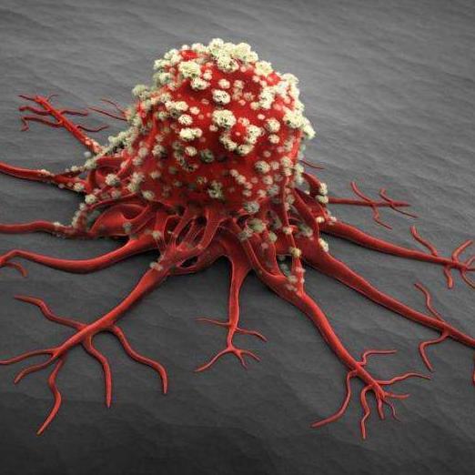 每天10人死于艾滋病,嘴巴出现3 特征 ,病毒已 蓄