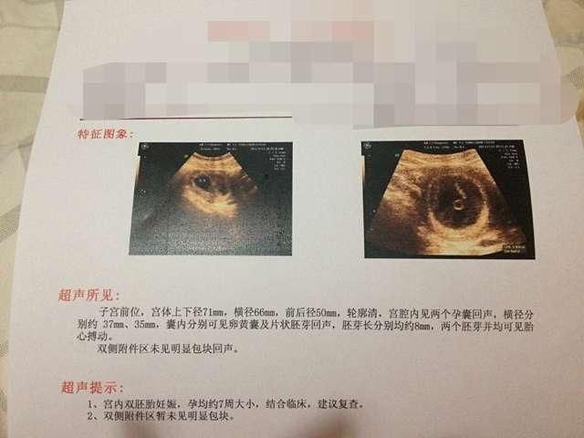 婆婆着急抱孙子,劝说未果,无奈自己怀二胎,儿媳无法接受
