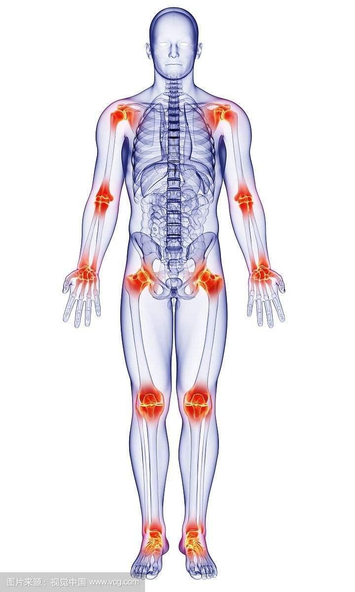 经常无缘无故地感到“周身骨痛”，什么原因?