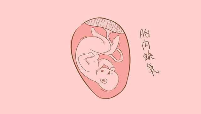 这种胎动是胎儿缺氧的求救信号,准妈妈要学会