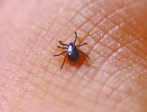 因蜱虫叮咬!苏州一男子感染新型布尼亚病毒身