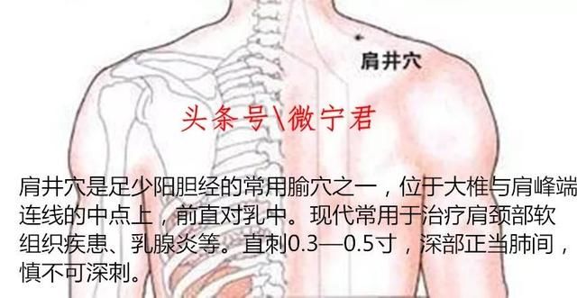 治疗肩膀肌肉僵硬、酸痛的穴位及指压法