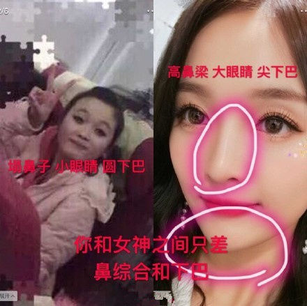 吴宣仪整容前后对比照曝光 和周洁琼共用同款