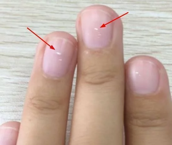 2018年03月08日 - 锦上添花 - 锦上添花博客 2018年03月08日 - 锦上添花 - 锦上添花博客
