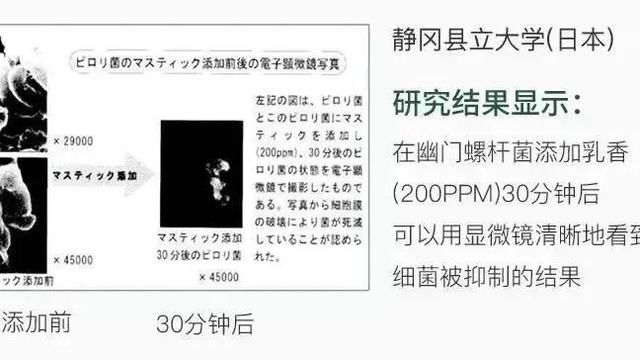 我花4000块做的牙齿护理,竟然还比不过一支牙