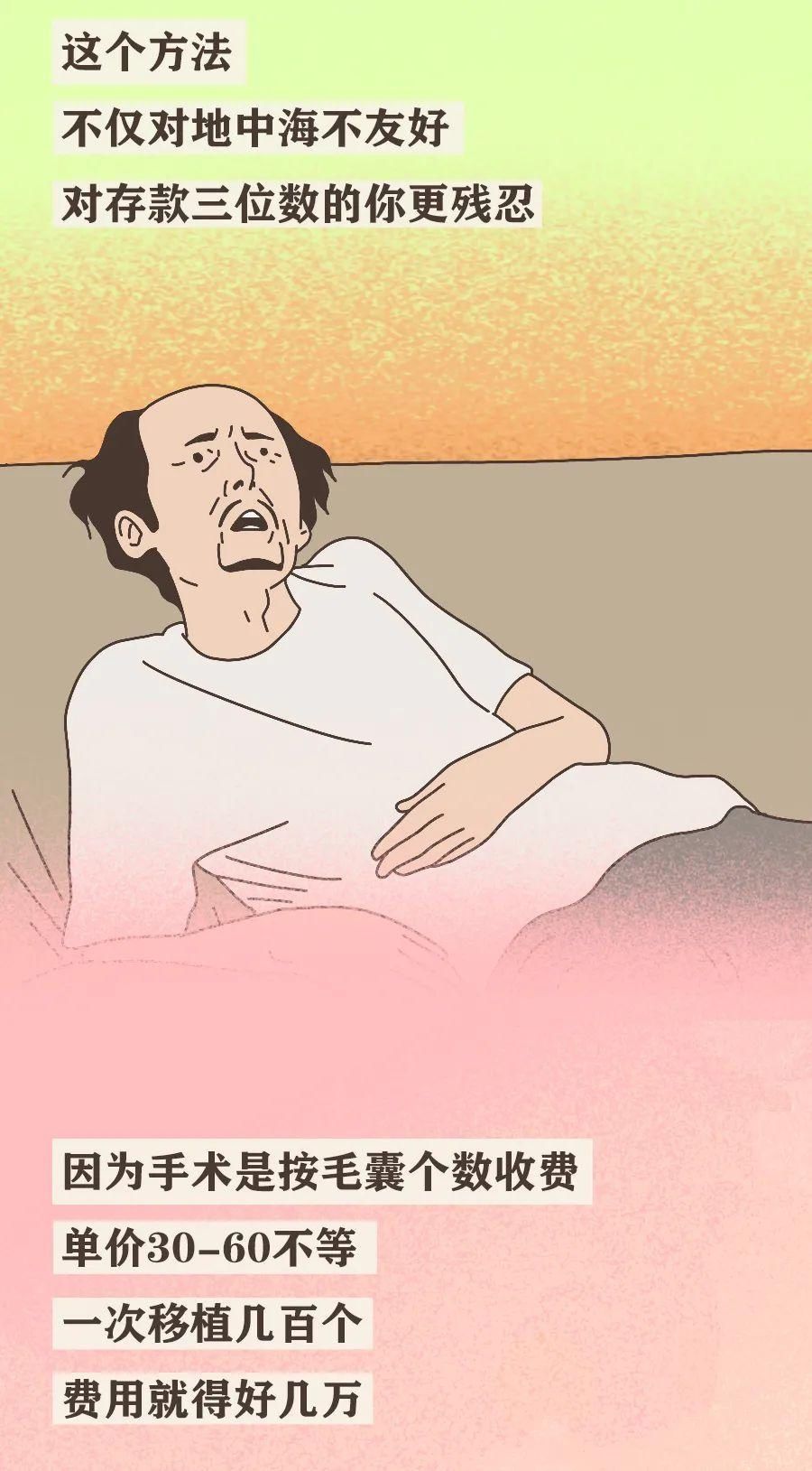 真男人，都容易秃