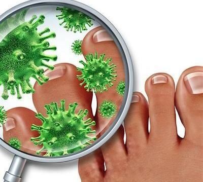 脚气是一种真菌感染性皮肤病,那脚气传染的途