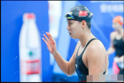 傅园慧得冠军反被喷,赛前胳膊惊现恐怖抓痕,网