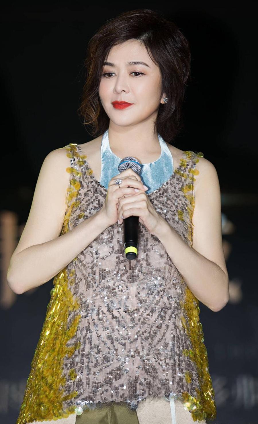 关之琳近照曝光! 手臂老年斑醒目, 住价值1.5亿