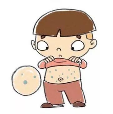 预防水痘小妙招快来收藏吧