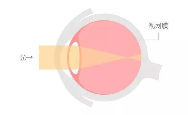 四眼仔就读书棒？面对这种谣言，专家说：“是真的”