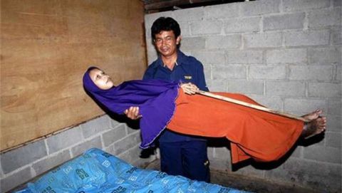 印尼35岁妇女染上怪病,身体僵硬无法弯腰被称