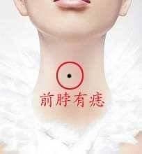 痣生于人体的隐处多吉，生于显处则多凶