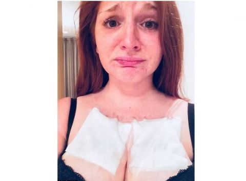 女子一夜之间浑身长满肿瘤,去医院检查医生的