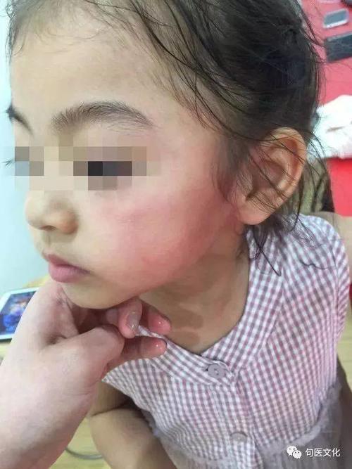 【科普长廊】牙痛还会影响眼睛,你知道吗?