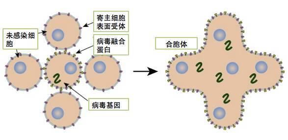 孩子发烧咳嗽不见好，很可能不是流感而是RSV