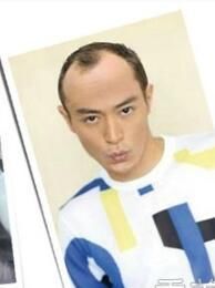 霍建华秃顶,李易峰秃顶,杨洋秃顶,就连小凯也秃
