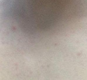 皮肤保护层是什么 t015abd2d14b8024c8f.jpg