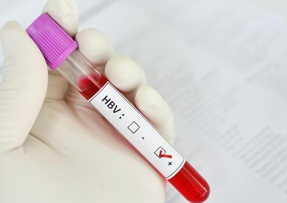 经常和乙肝患者共用碗筷, 会被传染吗? 应该怎