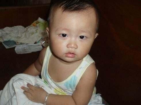 2岁宝宝无故肚子痛,数月后脑袋里查出肿瘤,这