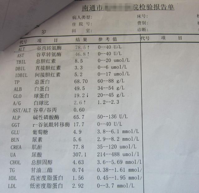 肝受损，身体有什么异样?医生:一项指标一查便知!