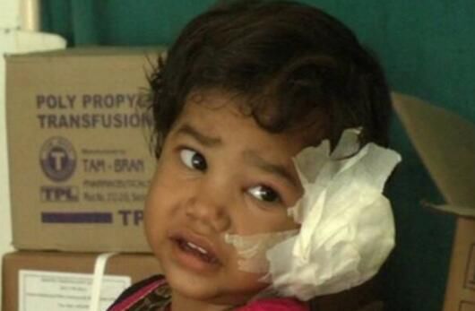 4岁姑娘耳朵疼痛难忍,到医院后,医生竟从她耳