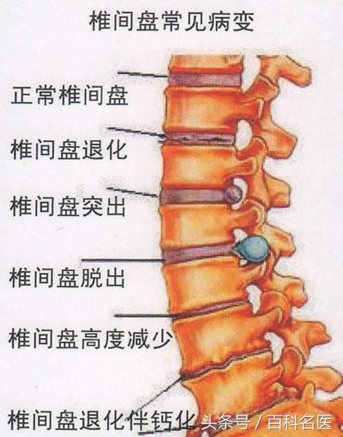 一家人过年突然都腰疼？原来因为打麻将！