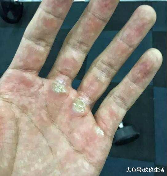 男性手上长茧说明什么?