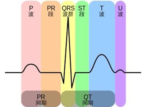 心电图异常未必是冠心病