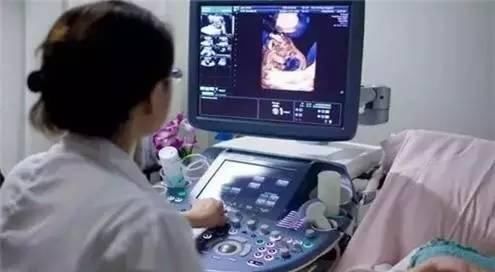 大排畸检查多少钱