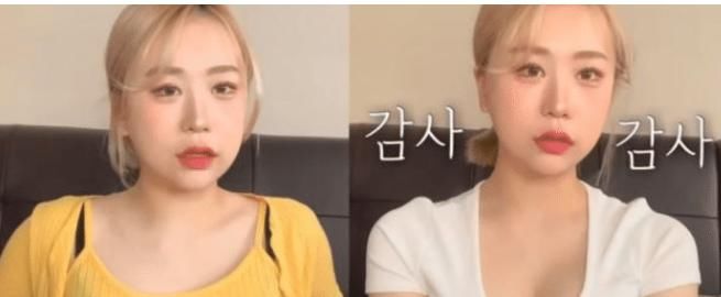 初中生辍学沉迷整容，花费巨资一年整容20次