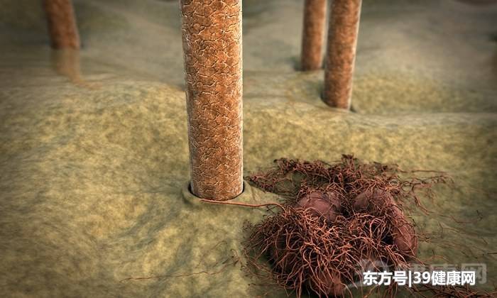 在现阶段,脱发不能彻底治愈!脱发一族如何自救